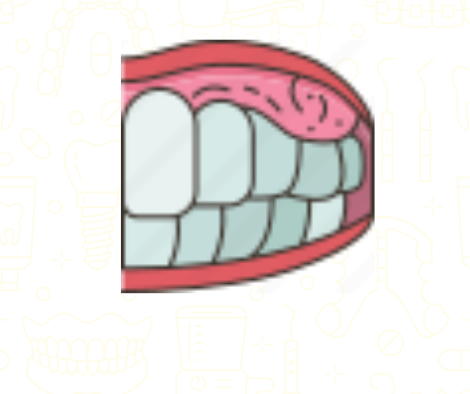 Oral Cancer  <br>  Screening