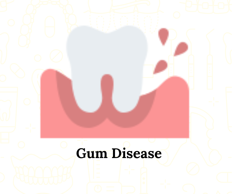 Gum Disease